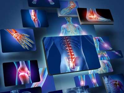 Injury X-Rays, similar to the types of evidence bodily injury lawyers would use in a case