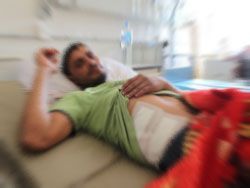 Personal Injury victim laying on a bed in a hospital